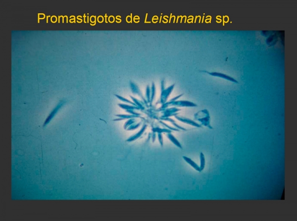Leishmaniosis. Proceso de descripción del brote en Uruguay