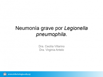 Neumonía grave por Legionella pneumophila