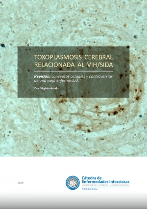 Toxoplasmosis cerebral relacionada al Vih/Sida
