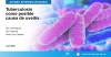 Tuberculosis como posible causa de uveítis