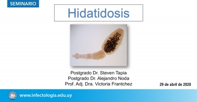 Hidatidosis