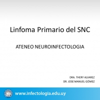 Linfoma Primario del SNC