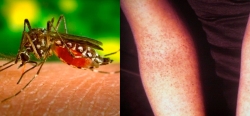 Dengue: actualización febrero 2013