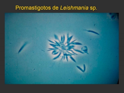 Leishmaniosis. Proceso de descripción del brote en Uruguay