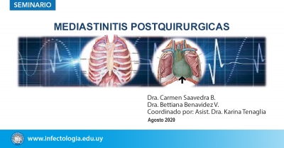 Mediastinitis postquirúrgicas