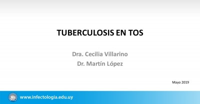 Tuberculosis en Tos