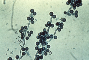 Mortality in patients with early -or late- onset candidaemia