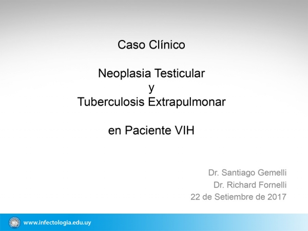 Neoplasia Testicular y Tuberculosis Extrapulmonar en Paciente VIH