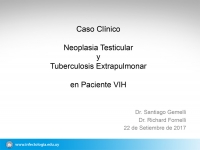 Neoplasia Testicular y Tuberculosis Extrapulmonar en Paciente VIH