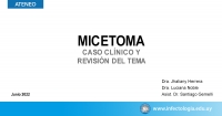 Micetoma - Caso clínico y revisión del tema